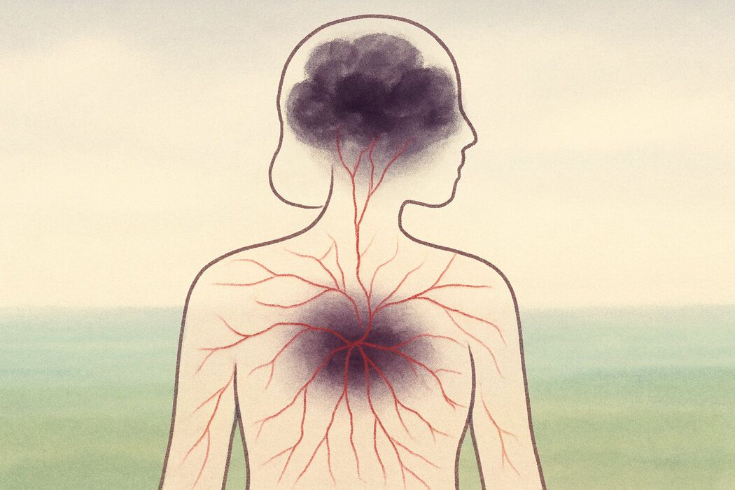 ����������� � ��������: ��� ���������� ������ ������ �� ����